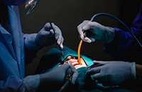 Dentist and assistant performing oral surgery